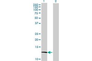 Western Blotting (WB) image for anti-ATPase, H+ Transporting, Lysosomal 13kDa, V1 Subunit G3 (ATP6V1G3) (AA 1-118) antibody (ABIN530580)