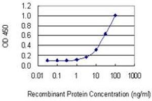 Detection limit for recombinant GST tagged PDLIM1 is 1 ng/ml as a capture antibody. (PDLIM1 Antikörper  (AA 123-232))