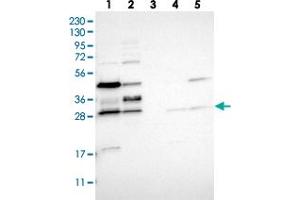 Western blot analysis of Lane 1: RT-4, Lane 2: U-251 MG, Lane 3: Human Plasma, Lane 4: Liver, Lane 5: Tonsil with RRP15 polyclonal antibody  at 1:250-1:500 dilution. (RRP15 Antikörper)