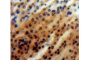 Used in DAB staining on fromalin fixed paraffin-embedded Kidney tissue (MAP4K5 Antikörper  (AA 613-842))