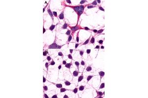 Immunocytochemistry (ICC) staining of HEK293 human embryonic kidney cells transfected (A) or untransfected (B) with GRM3.