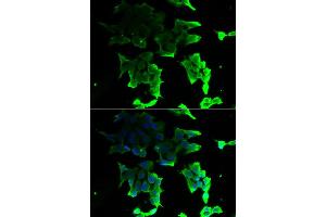 Immunofluorescence analysis of HeLa cell using TANK antibody. (TANK Antikörper)