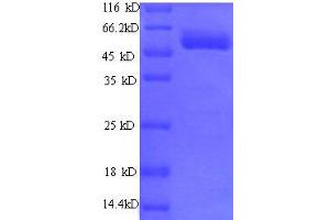 SDS-PAGE (SDS) image for Exostoses (Multiple)-Like 3 (EXTL3) (AA 2-245), (partial) protein (GST tag) (ABIN1608038)