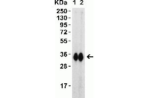 Western Blot Validation with SARS-CoV-2 (COVID-19) Spike RBD Recombinant Protein Loading: 30 ng per lane of SARS-CoV-2 (COVID-19) Spike RBD recombinant protein, 10-303. (SARS-CoV-2 Spike Antikörper  (RBD))