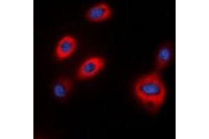 Immunofluorescent analysis of TPH1 staining in HepG2 cells. (Tryptophan Hydroxylase 1 Antikörper  (N-Term))