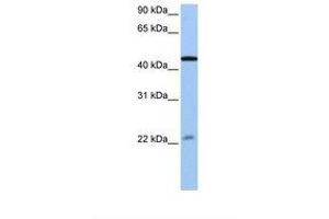 Image no. 1 for anti-Ewing Sarcoma Breakpoint Region 1 (EWSR1) (AA 173-222) antibody (ABIN6737947) (EWSR1 Antikörper  (AA 173-222))