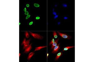 Immunofluorescence of Histone H4 K12-Ac (RABBIT) Antibody: Histone H4 K12-Ac antibody was tested in HeLa cells with DyLight 488 (green). (Histone H4 Antikörper  (acLys12))
