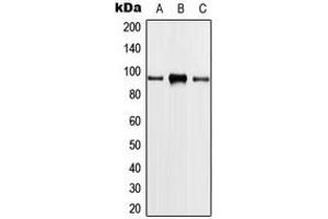Western blot analysis of PLA2G4A expression in HeLa (A), THP1 (B), NIH3T3 (C) whole cell lysates. (PLA2G4A Antikörper  (Center))