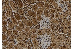 Immunohistochemistry (IHC) image for anti-Tumor Necrosis Factor, alpha-Induced Protein 3 (TNFAIP3) (Internal Region) antibody (ABIN6265632)