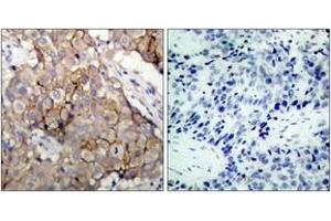 Immunohistochemistry (IHC) image for anti-Epidermal Growth Factor Receptor (EGFR) (AA 1061-1110) antibody (ABIN2888974) (EGFR Antikörper  (AA 1061-1110))