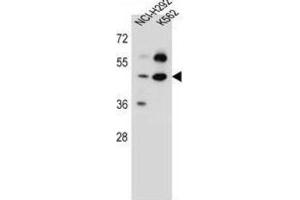 Western Blotting (WB) image for anti-Leprecan-Like 4 (LEPREL4) antibody (ABIN5016836) (Leprecan-Like 4 Antikörper)