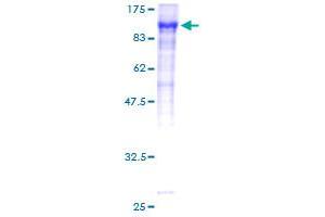 Image no. 1 for Coagulation Factor XIII, A1 Polypeptide (F13A1) (AA 1-732) protein (GST tag) (ABIN1353305)