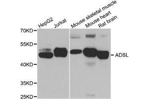 Western blot analysis of extracts of various cell lines, using ADSL antibody.