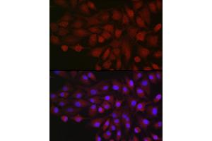 Immunofluorescence analysis of  cells using BDKRB1 Rabbit pAb (ABIN7265910) at dilution of 1:250 (40x lens). (BDKRB1 Antikörper  (AA 1-100))