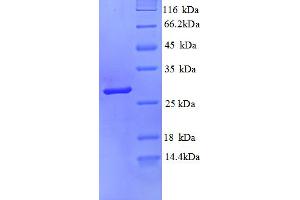 SDS-PAGE (SDS) image for Protease, serine, 3 (PRSS3) (AA 81-303), (partial) protein (His tag) (ABIN5712820)