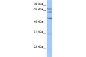 Western Blotting (WB) image for anti-Testis-Specific serine Kinase Substrate (TSKS) antibody (ABIN2463604)