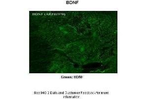 Immunohistochemistry (IHC) image for anti-Brain-Derived Neurotrophic Factor (BDNF) (Middle Region) antibody (ABIN502195) (BDNF Antikörper  (Middle Region))