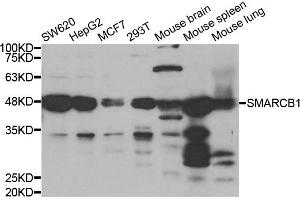 Western blot analysis of extracts of various cell lines, using SMARCB1 antibody. (SMARCB1 Antikörper)
