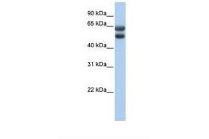 Image no. 1 for anti-Zinc Finger Protein 331 (ZNF331) (AA 51-100) antibody (ABIN6737784) (ZNF331 Antikörper  (AA 51-100))