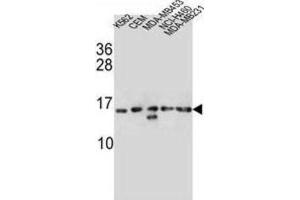 Western Blotting (WB) image for anti-Histone Cluster 1, H2ab (HIST1H2AB) antibody (ABIN2997115)