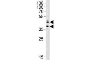 Western blot analysis of lysate from HUVEC cell line using CD34 antibody at 1:1000 for each lane.