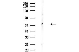 anti-Inositol Hexakisphosphate Kinase 3 (IP6K3) (Internal Region) antibody