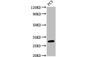 Western Blot Positive WB detected in: PC-3 whole cell lysate All lanes: MRO antibody at 3 μg/mL Secondary Goat polyclonal to rabbit IgG at 1/50000 dilution Predicted band size: 30, 25, 31, 24 kDa Observed band size: 30 kDa (MRO Antikörper  (AA 12-85))