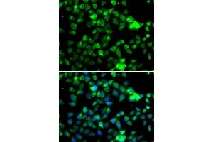 Immunofluorescence analysis of A-549 cells using NAA20 antibody. (NAT5 Antikörper  (AA 49-178))