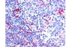 Immunohistochemistry (IHC) image for anti-Neuroepithelial Cell Transforming 1 (NET1) (C-Term) antibody (ABIN2465993) (NET1 Antikörper  (C-Term))