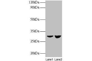 Western blot All lanes: UQCRFS1 antibody at 2 μg/mL Lane 1: EC109 whole cell lysate Lane 2: 293T whole cell lysate Secondary Goat polyclonal to rabbit IgG at 1/15000 dilution Predicted band size: 30 kDa Observed band size: 30 kDa (UQCRFS1 Antikörper  (AA 79-274))