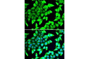 Immunofluorescence analysis of A549 cells using HDAC5 antibody. (HDAC5 Antikörper  (AA 350-450))