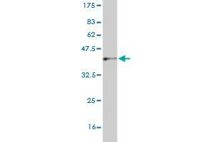 Western Blot detection against Immunogen (37. (CNDP2 Antikörper  (AA 191-300))