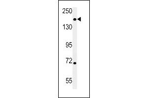 DI3L1 Antibody (N-term) (ABIN651802 and ABIN2840405) western blot analysis in mouse heart tissue lysates (15 μg/lane). (DIS3L Antikörper  (N-Term))