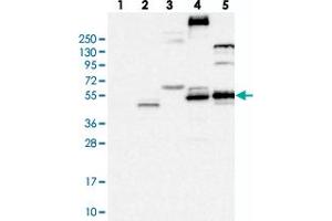 Western blot analysis of Lane 1: RT-4, Lane 2: U-251 MG, Lane 3: Human Plasma, Lane 4: Liver, Lane 5: Tonsil with FLVCR2 polyclonal antibody . (FLVCR2 Antikörper)