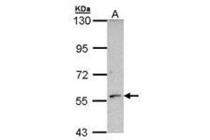 Image no. 1 for anti-Cytochrome P450, Family 21, Subfamily A, Polypeptide 2 (CYP21A2) (AA 120-386) antibody (ABIN467561) (CYP21A2 Antikörper  (AA 120-386))
