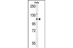 Western Blot in Hela cell line lysates (35ug/lane). (ADCY4 Antikörper  (AA 415-441))