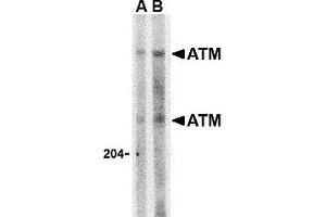 Western Blotting (WB) image for anti-Ataxia Telangiectasia Mutated (ATM) (C-Term) antibody (ABIN1030266) (ATM Antikörper  (C-Term))