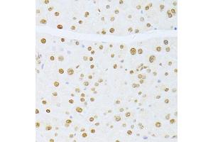 Immunohistochemistry of paraffin-embedded mouse pancreas using ETV1 antibody (ABIN6129794, ABIN6140327, ABIN6140329 and ABIN6217250) at dilution of 1:100 (40x lens). (ETV1 Antikörper  (AA 80-300))