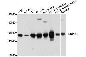 Western blot analysis of extracts of various cell lines, using SRPRB antibody. (SRPRB Antikörper  (AA 57-271))