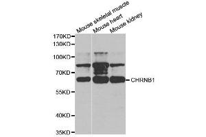 Western Blotting (WB) image for anti-Nicotinic Acetylcholine Receptor beta (CHRNB1) antibody (ABIN1876483) (CHRNB1 Antikörper)