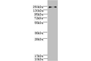 Western blot All lanes: PLA2R1 antibody IgG at 0.