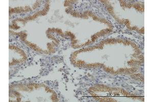 Immunoperoxidase of monoclonal antibody to MUSK on formalin-fixed paraffin-embedded human endometrium.