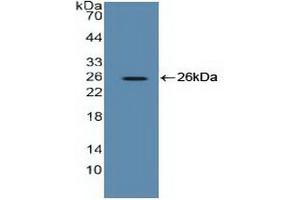 Detection of Recombinant EEF2, Human using Polyclonal Antibody to Eukaryotic Translation Elongation Factor 2 (EEF2) (EEF2 Antikörper  (AA 32-233))
