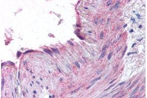 Immunohistochemical staining of human small intestine, vessel with CCR1 polyclonal antibody . (CCR1 Antikörper  (N-Term))