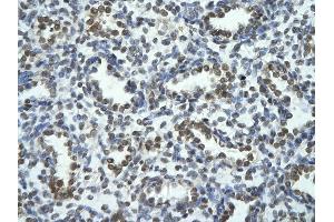 Rabbit Anti-TRIOBP Antibody       Paraffin Embedded Tissue:  Human alveolar cell   Cellular Data:  Epithelial cells of renal tubule  Antibody Concentration:   4. (TRIOBP Antikörper  (Middle Region))