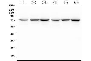 Western blot analysis of SLC5A2 using anti-SLC5A2 antibody (ABIN6719506).