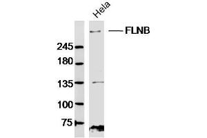 Hela lysates probed with FLNB Polyclonal Antibody, Unconjugated  at 1:300 dilution and 4˚C overnight incubation.