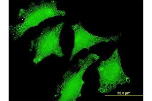 Immunofluorescence of monoclonal antibody to DND1 on HeLa cell. (DND1 Antikörper  (AA 167-260))