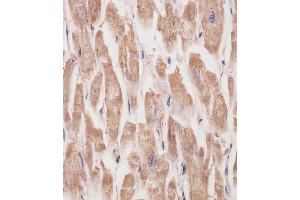 (ABIN6242162 and ABIN6577231) staining KANK1 in human heart tissue sections by Immunohistochemistry (IHC-P - paraformaldehyde-fixed, paraffin-embedded sections). (ANKRD15 Antikörper)