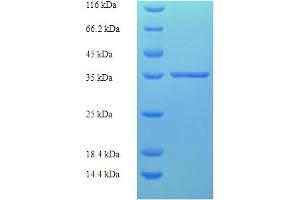 SDS-PAGE (SDS) image for Zinc Finger, Matrin-Type 5 (ZMAT5) (AA 1-170), (full length) protein (His-SUMO Tag) (ABIN5711799)